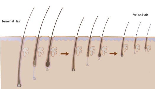 Three Types of Natural Human Hair