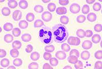 Neutrophils